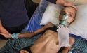 Gazze’de yardım almaya giderken başından vurularak felç kalan 16 yaşındaki Muhenned adeta “iskelete” dönüştü
