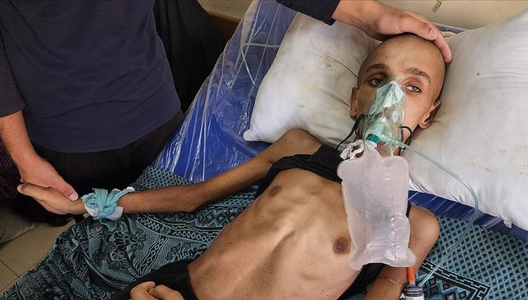 Gazze’de yardım almaya giderken başından vurularak felç kalan 16 yaşındaki Muhenned adeta “iskelete” dönüştü