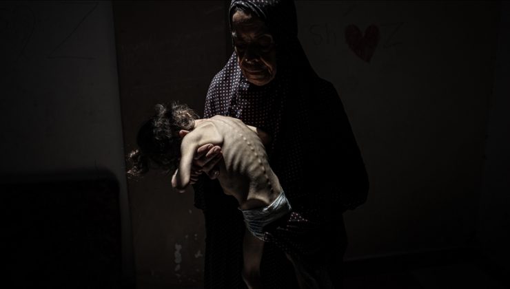 İsrail’in kıtlığı dayattığı Gazze’de son 24 saatte 4 kişi daha açlıktan hayatını kaybetti